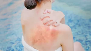 perawatan kulit